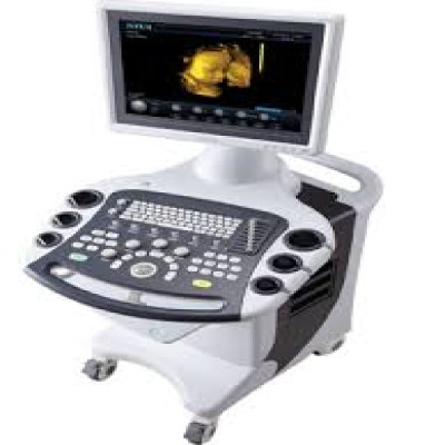 4D color Doppler